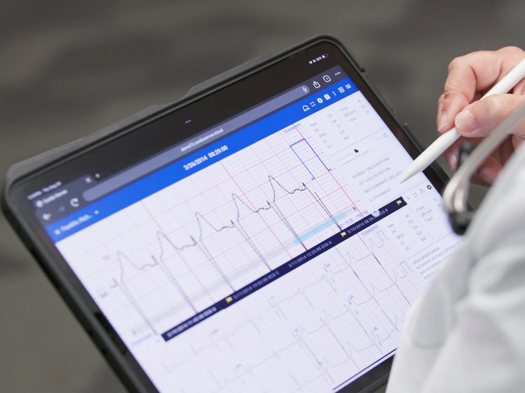 Clinician annotates an ECG readout on a tablet