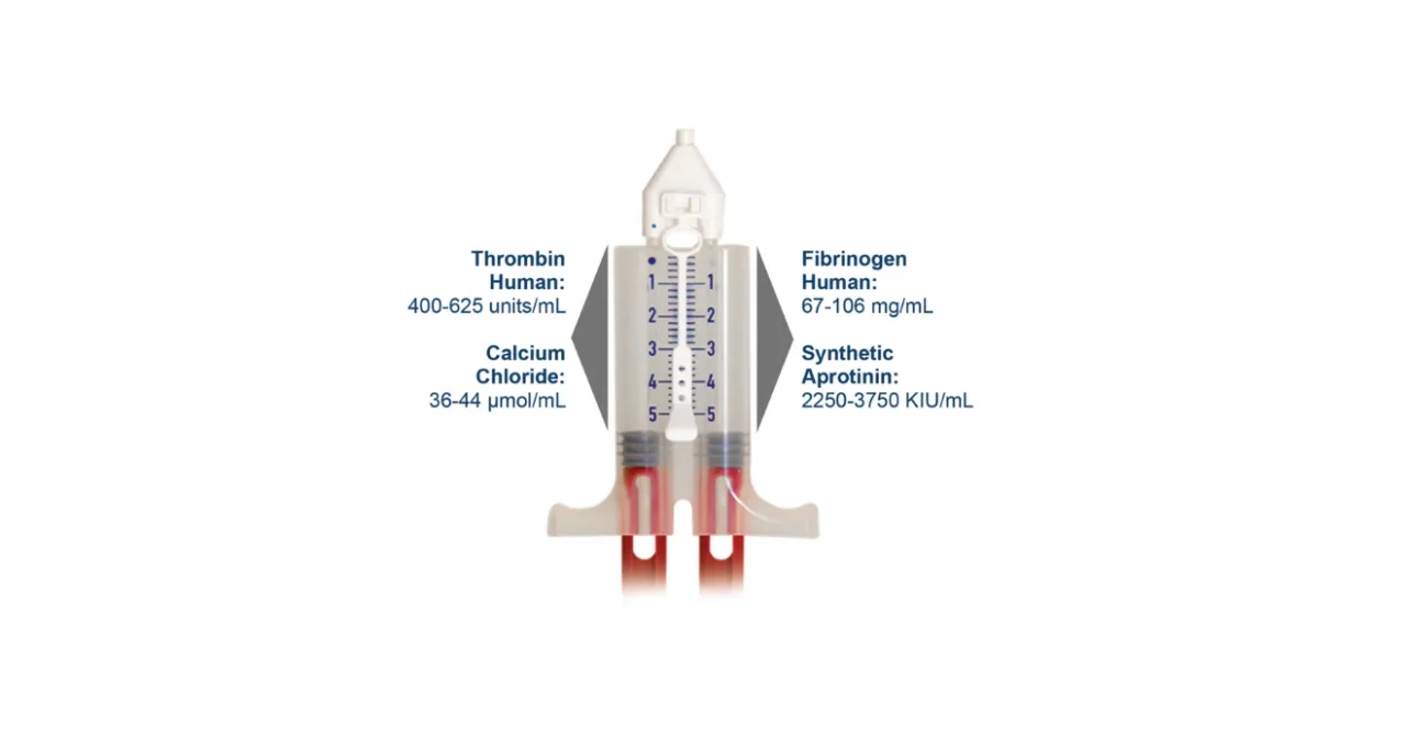 Tisseel syringe with labels for Thrombin human, Calcium chloride, Fibrinogen Human, Synthetic Aprotinin