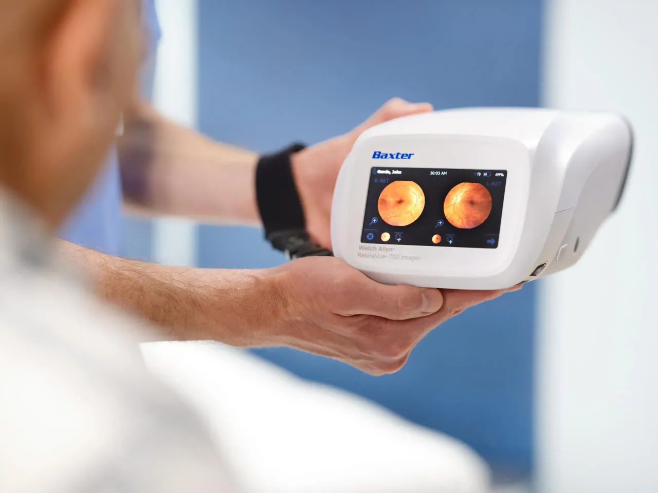 baxter_welch_allyn_retinavue700-imager
